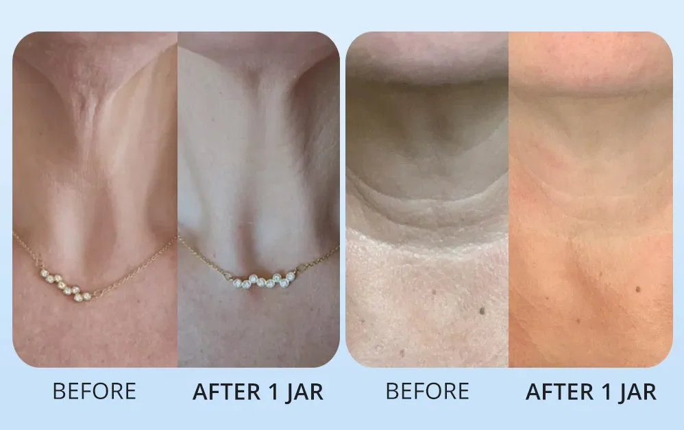 The Viral Neck Cream Was Just the Beginning – goPure’s Body Line Is Changing Everything