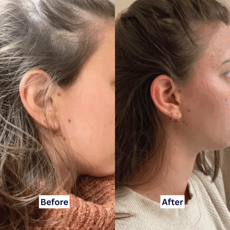 Evergreen-Static-BeforeAfter-XA-XB-XC-C24