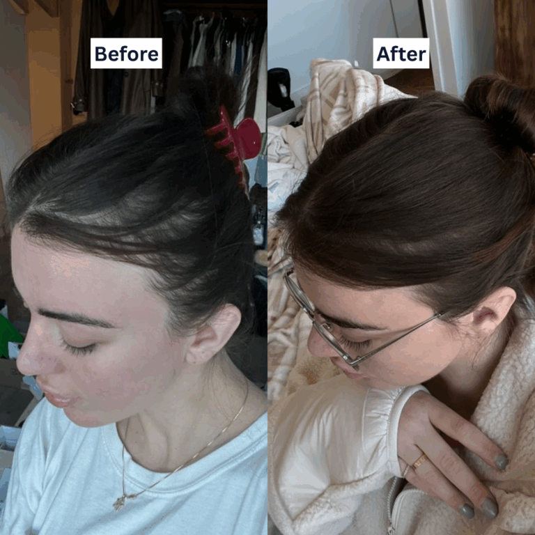 Evergreen-Static-BeforeAfter-XA-XB-XC-C25