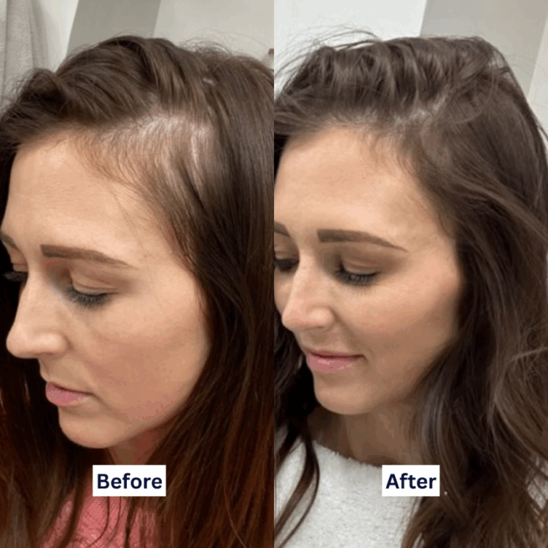 Evergreen-Static-BeforeAfter-XA-XB-XC-C26
